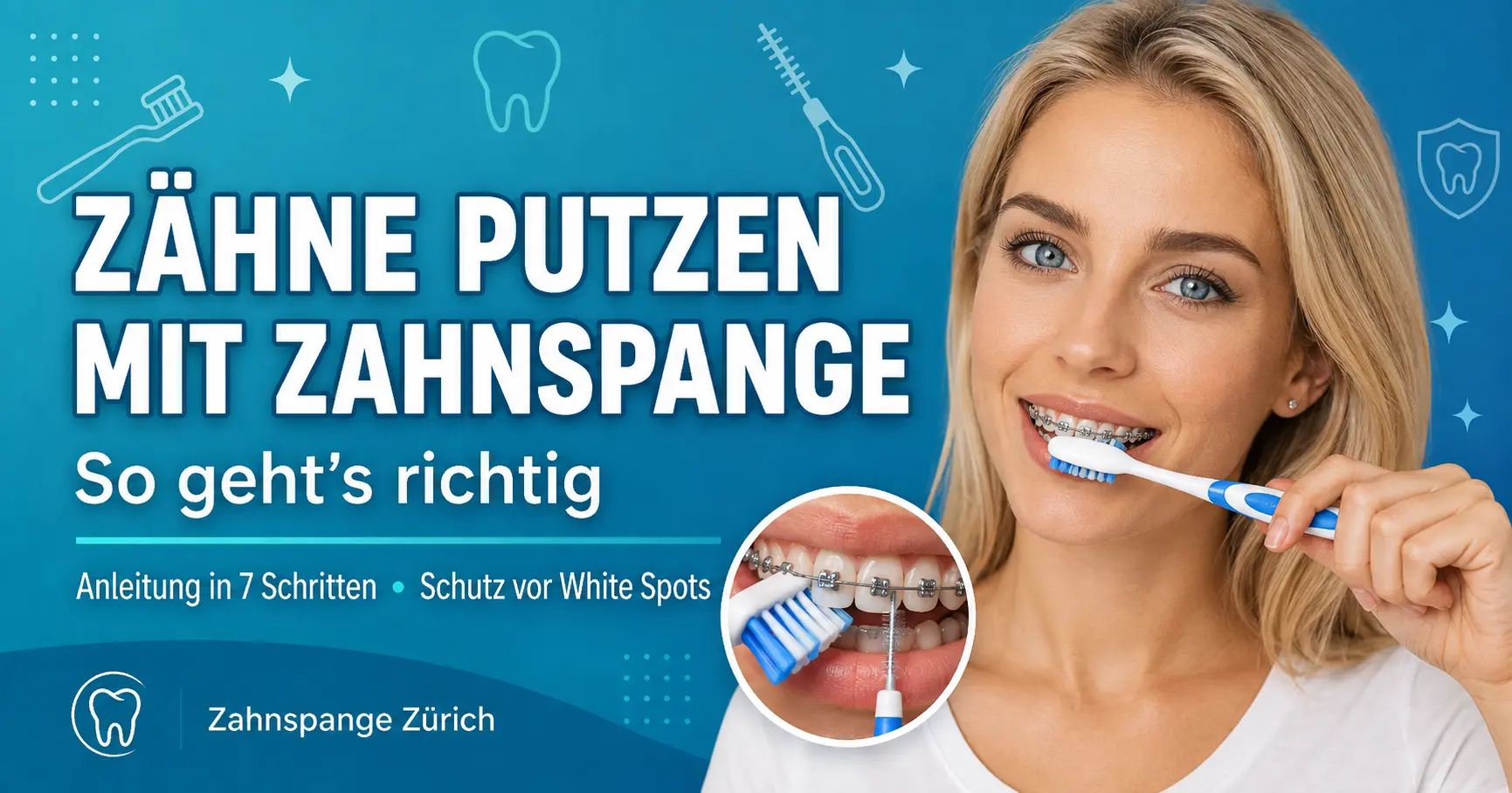 Zähne putzen mit Zahnspange – Anleitung in 7 Schritten Zähne mit fester Zahnspange richtig putzen: Zahnbürste und Interdentalbürste reinigen Brackets und Zahnzwischenräume.