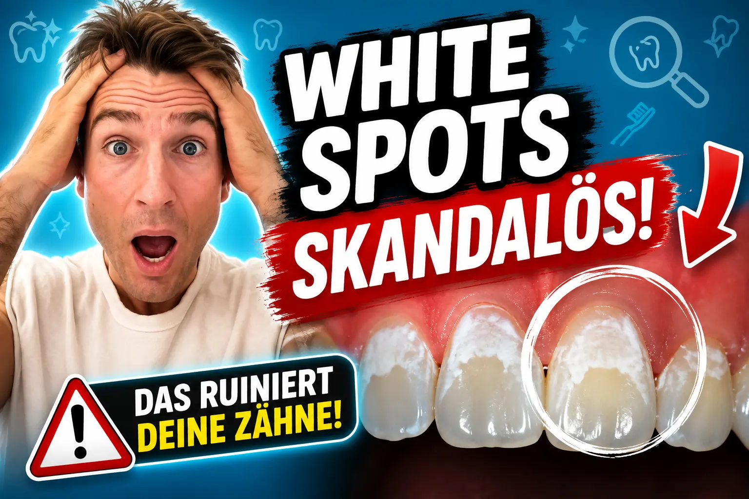 White Spots Skandalös – Weisse Flecken nach Zahnspangen White Spots Skandalös – Headerbild zum Blogartikel über weisse Flecken nach Zahnspangen